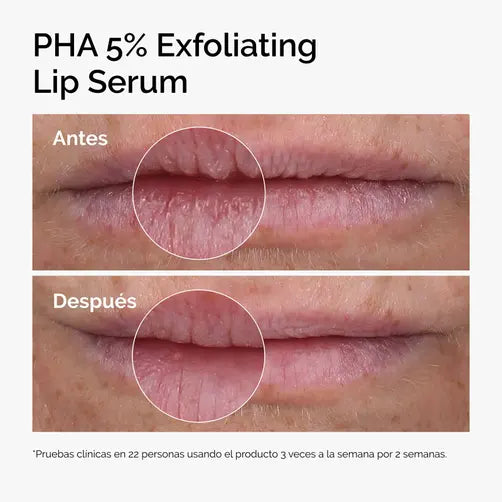 The Ordinary PHA 5% Exfoliating Lip Serum 15 ml