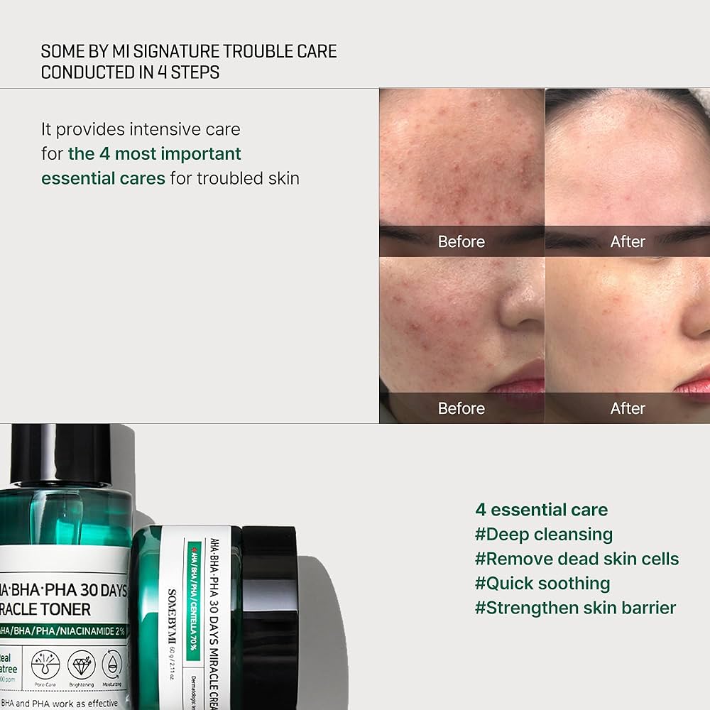 Kit Facial AHA BHA PHA 30 Días Miracle Starter – Rutina Coreana de Cuidado de la Piel con Toner, Sérum, Crema y Jabón Limpiador – Con Árbol de Té y Centella Asiática