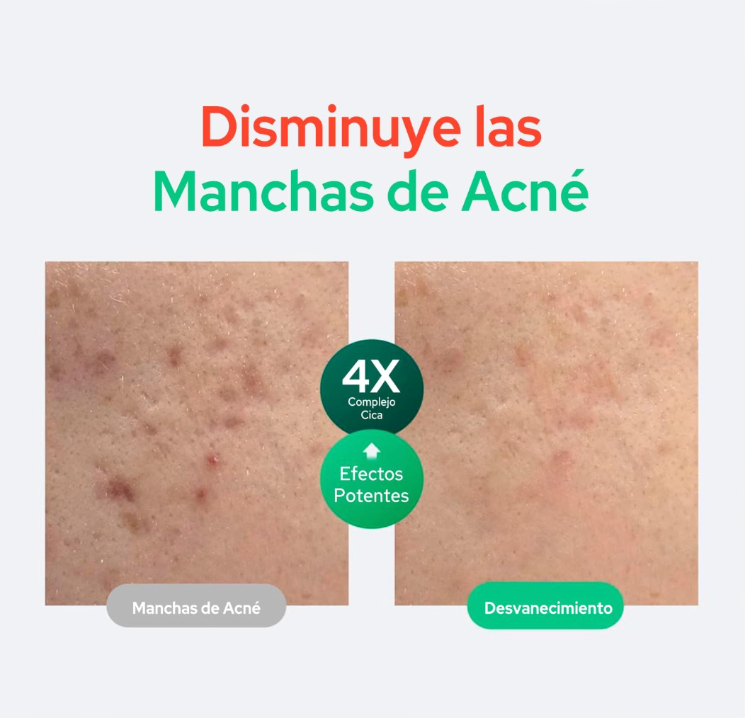 PURITO Wonder Releaf Centella Serum Unscented 60ml