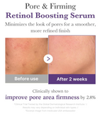 MEDICUBE Retinol Boosting Serum 30ml