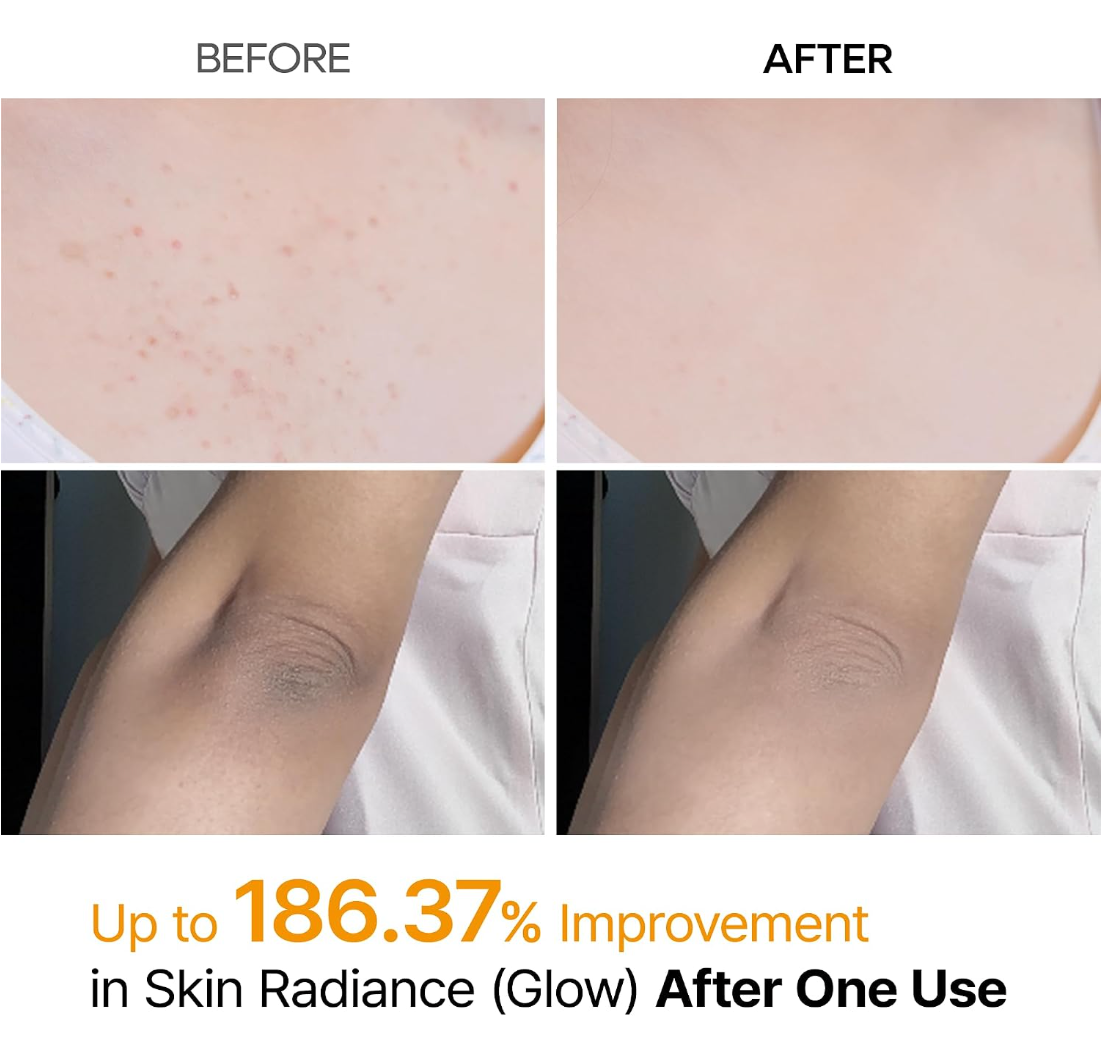 DR. MELAXIN Exfoliating Kojic Acid Turmeric Spray 200ml