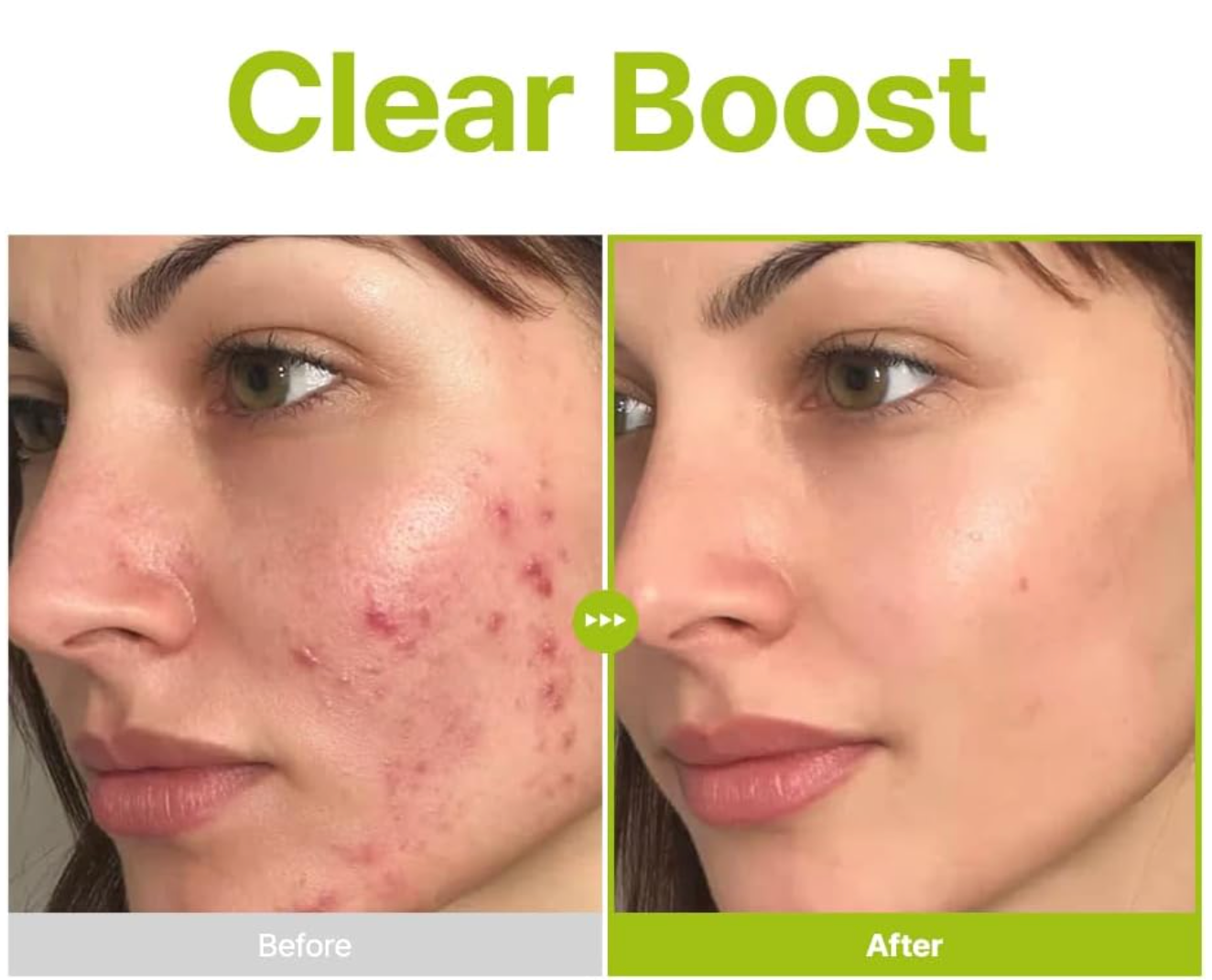 PURITO Azelaic Ácido 10 Kojic Tea Tree Serum 30ml