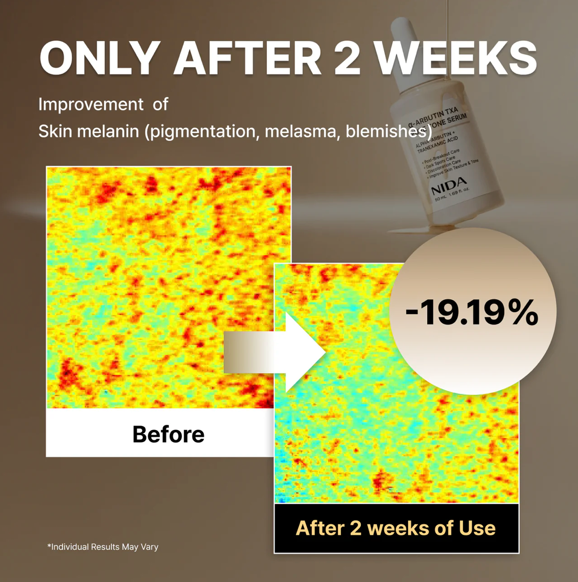 NIDA A-Arbutin TXA Pure Tone Serum