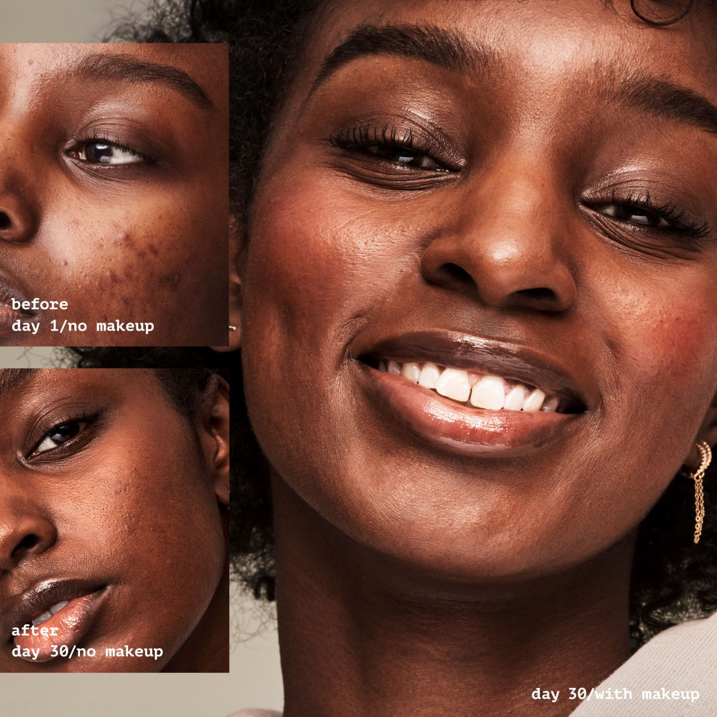 ELF Acne Fighting Putty Primer con Ácido Salicílico