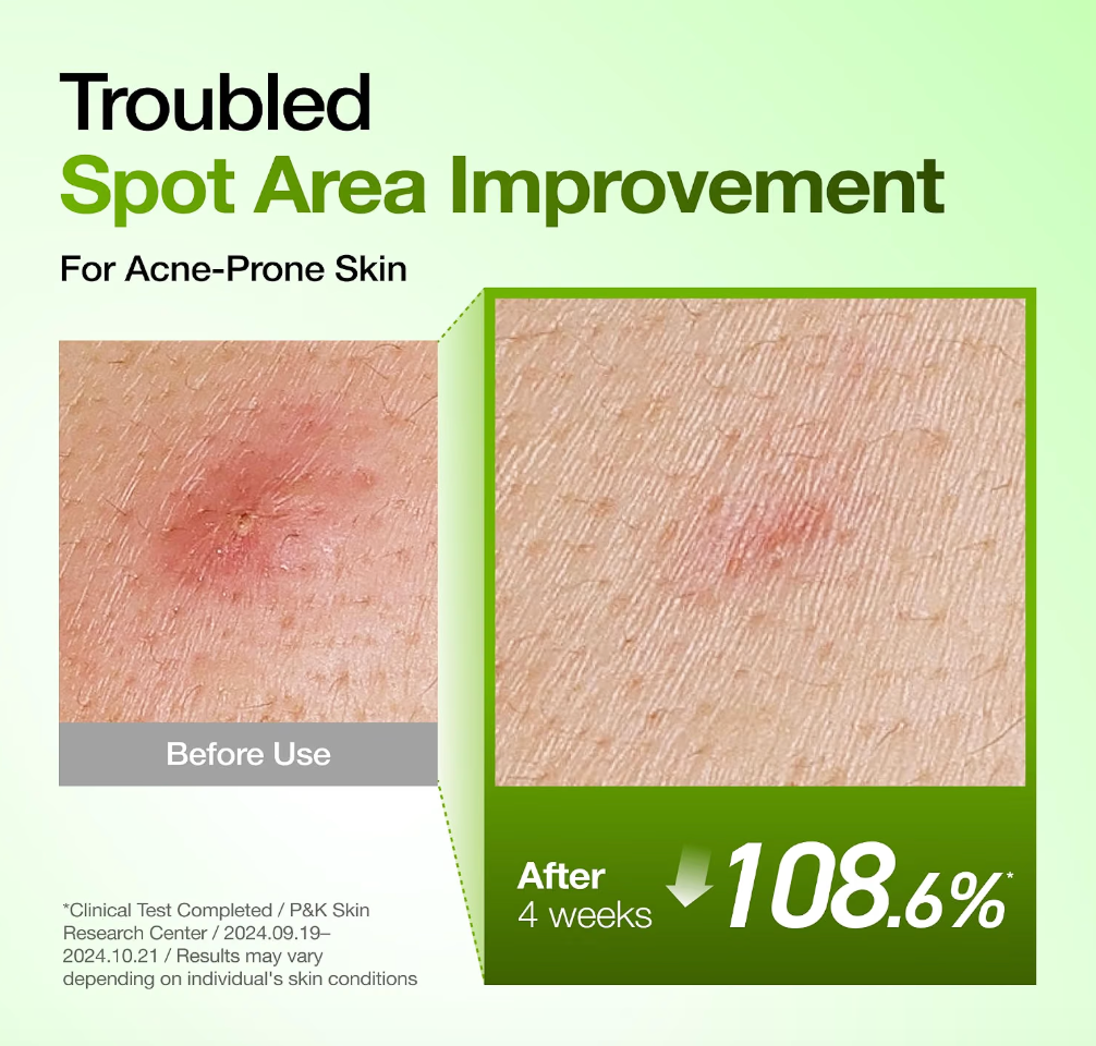 ANUA Azelaic Acid 10+ Hyaluron Serum 30ml