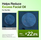ANUA Azelaic Acid 10+ Hyaluron Serum 30ml