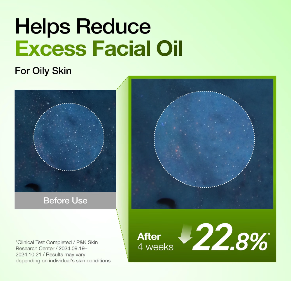 ANUA Azelaic Acid 10+ Hyaluron Serum 30ml