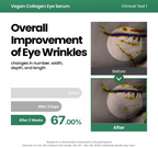 AXIS-Y Vegan Collagen Eye Serum 10ml