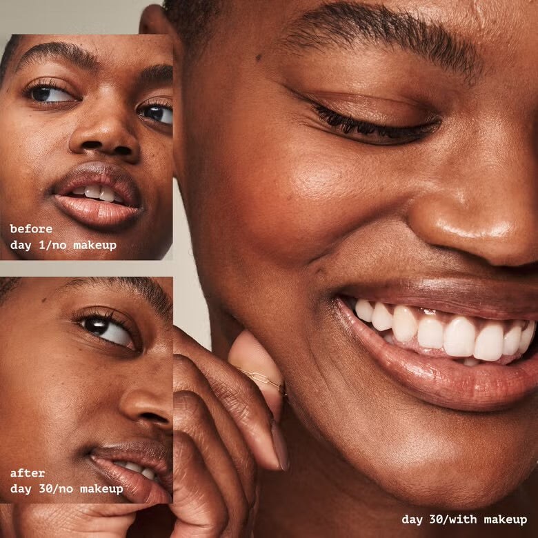 ELF Acne Fighting Putty Primer – Universal Sheer (1.8% Ácido Salicílico) 21g